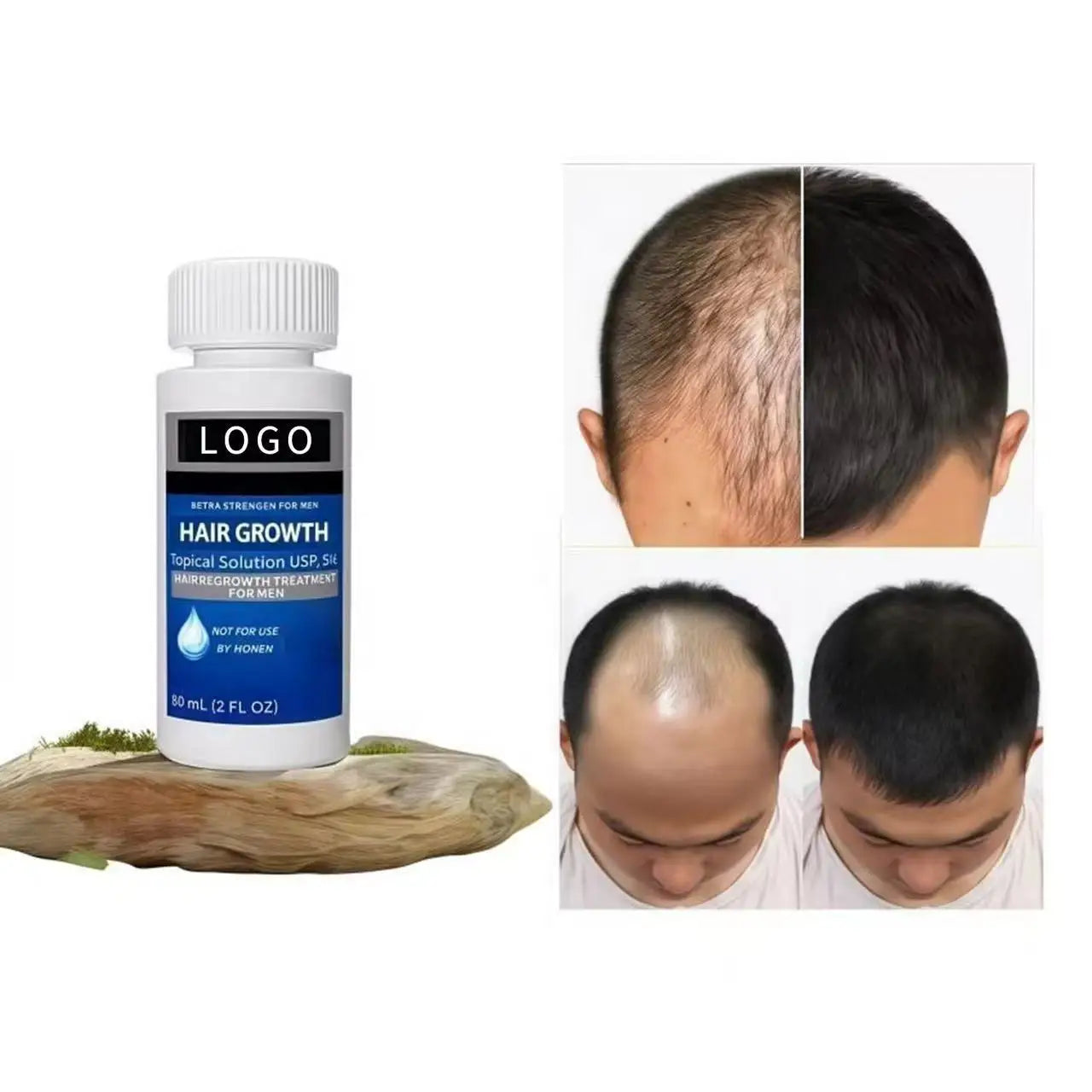 OEM 5% Biotin Nourishing Organic Hair Growth Serum & Booster Oil Kit for Normal Hair-Hair Regrowth & Dry/Damaged Hair Care