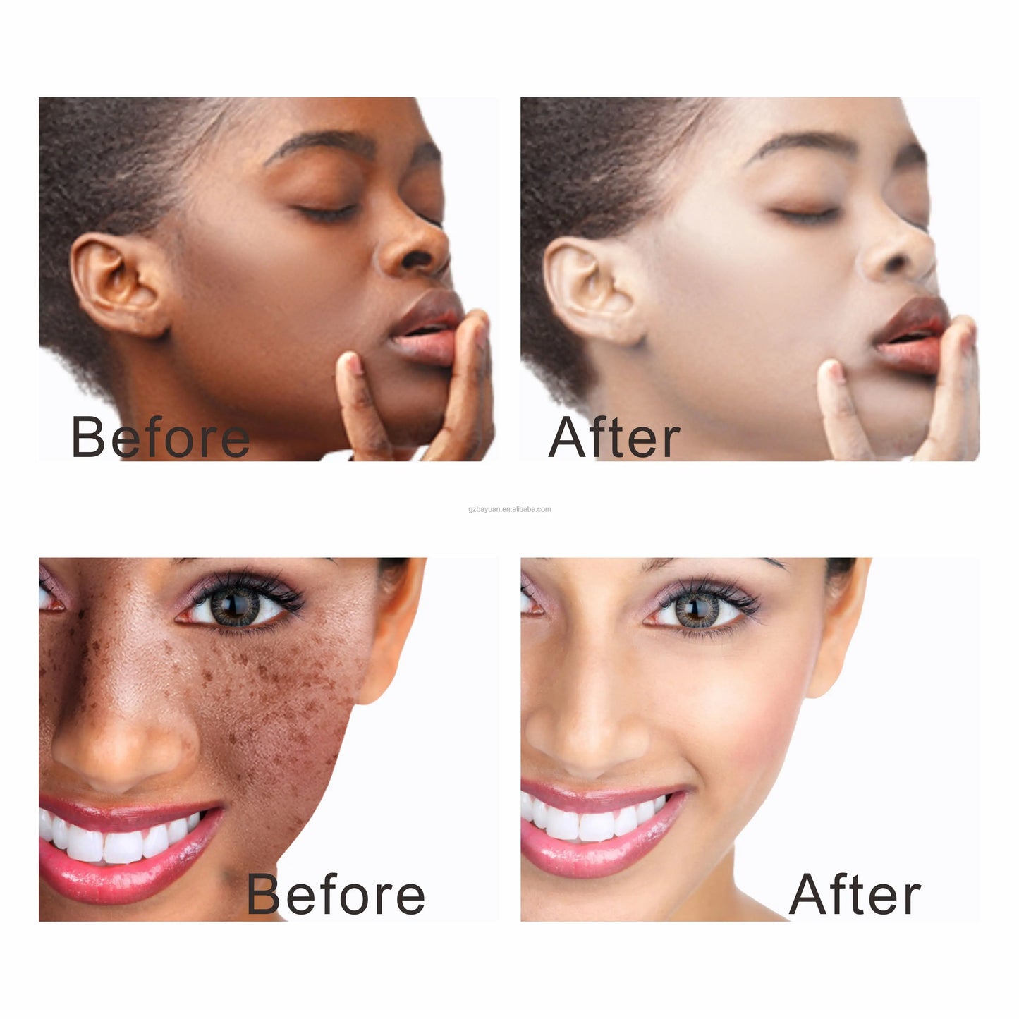 Private Label Super Whitening Dark Spot Remove Anti-Aging Face & Body Shimmer Serum Oil Ginger Hyaluronic Acid Organic