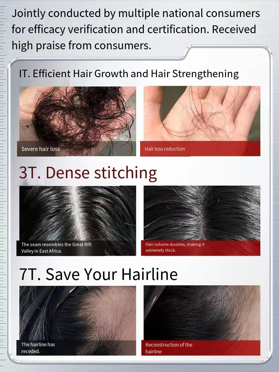 MOARCCI DNA Oil Control Anti-Hair Loss Hair Growth Set Hair Growth Serum Anti-Dandruff Shampoo Organic Rosemary Liquid