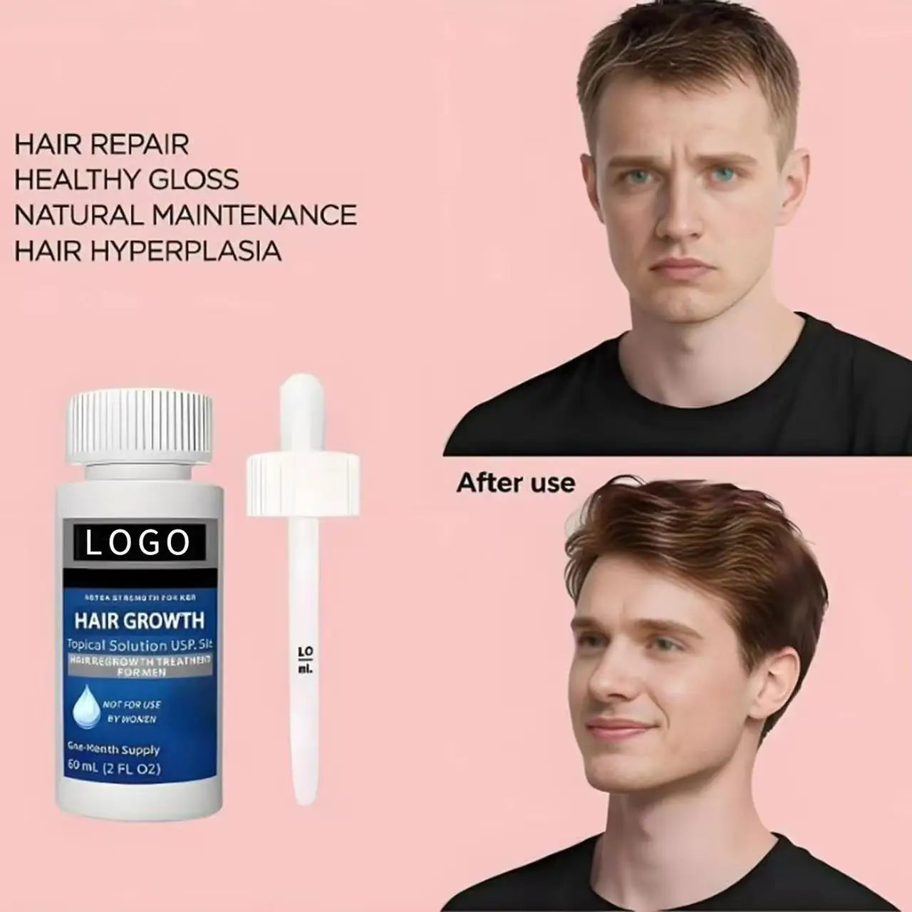 OEM 5% Biotin Nourishing Organic Hair Growth Serum & Booster Oil Kit for Normal Hair-Hair Regrowth & Dry/Damaged Hair Care