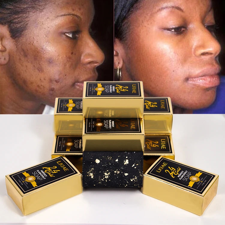 New Arrival Organic Bamboo Charcoal Vitamin C Brightening Handmade Soap Custom in Stock Oil Control 24k Gold Soap for Black Skin