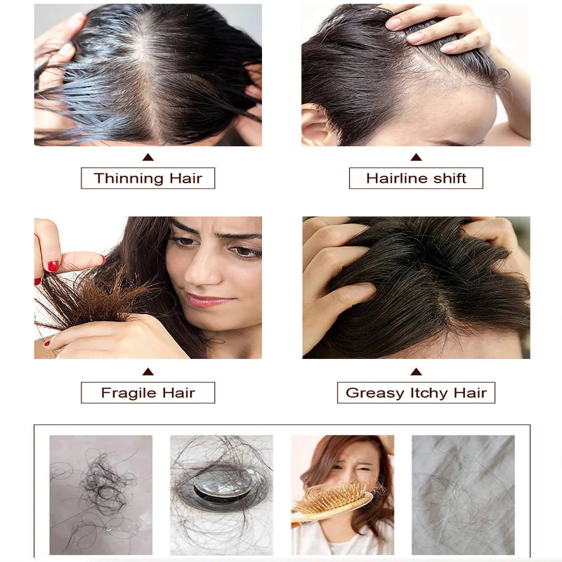 OEM/ODM Private Label Organic Components Hair Loss Nourishing Repair Hair Growth Onion Shampoo and Conditioner Set
