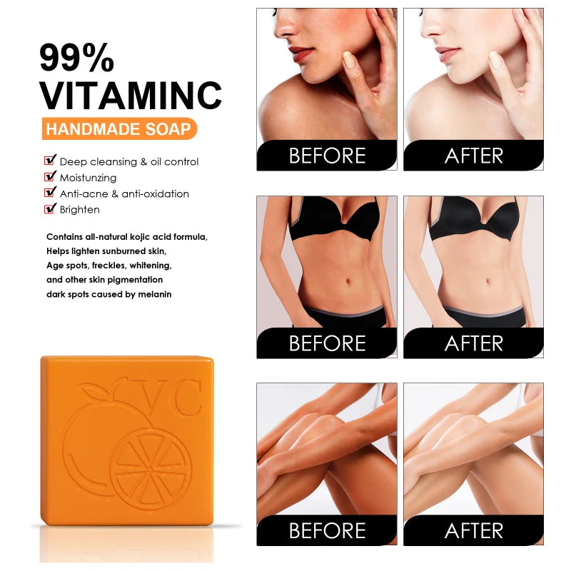 Private Label Organic Handmade Soap Whitening Body Toilet Soap Bath Bar Deeply Cleanses and Nourishes Skin Vitamin C Soap