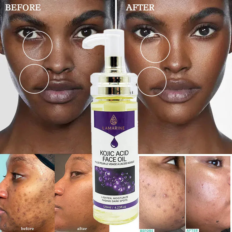 Wholesale Korean Cosmetics Skin Repair Acne Removal Kojic Acid Oil Natural Organic Vegan Anti-Aging Facial Care Oil