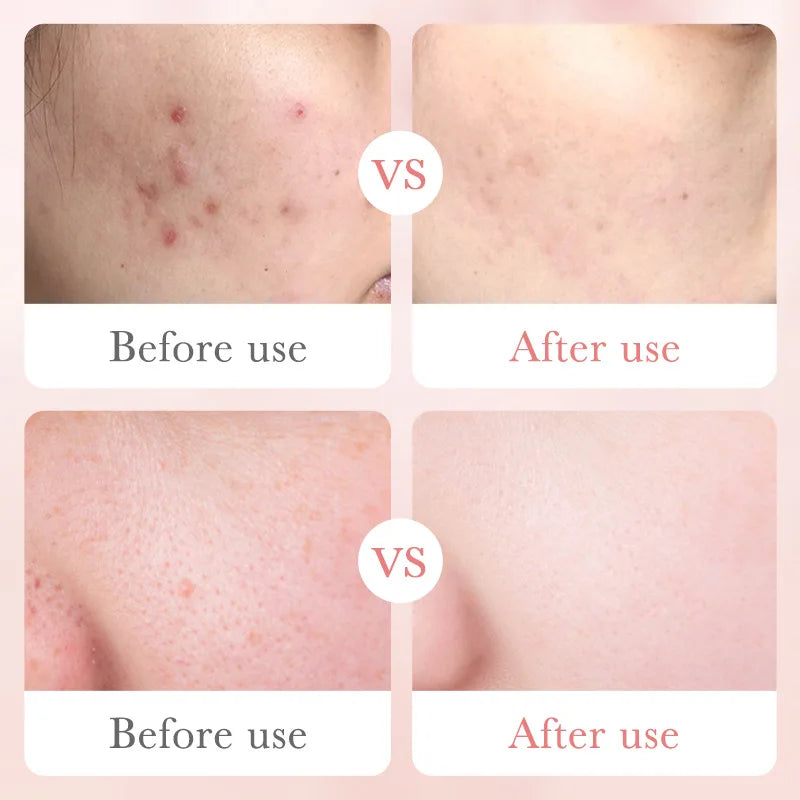 Organic Hyaluronic Acid Vitamin C Serum Cream Skincare Kit Natural Rose Extract Whitening Private Label Face Serum Organic