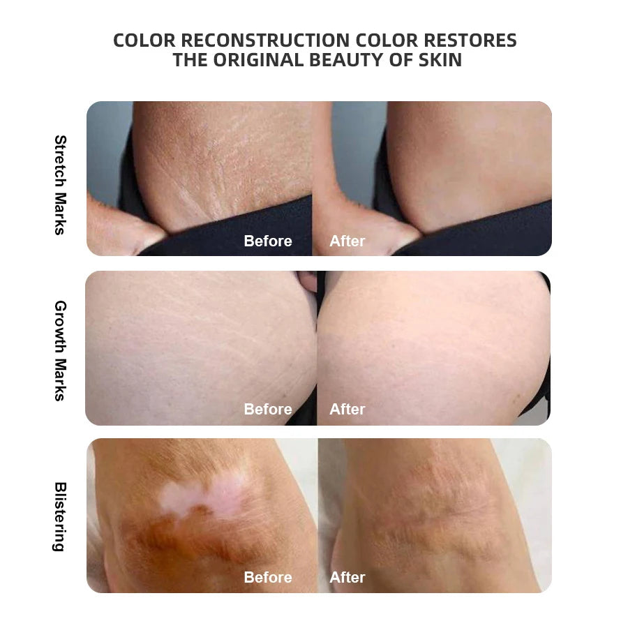 Organic Natural Plant-Based Tattoo Ink 15ml Model TY079 for Skin Tone Reconstruction and Scar Coverage Body & Lip Applications