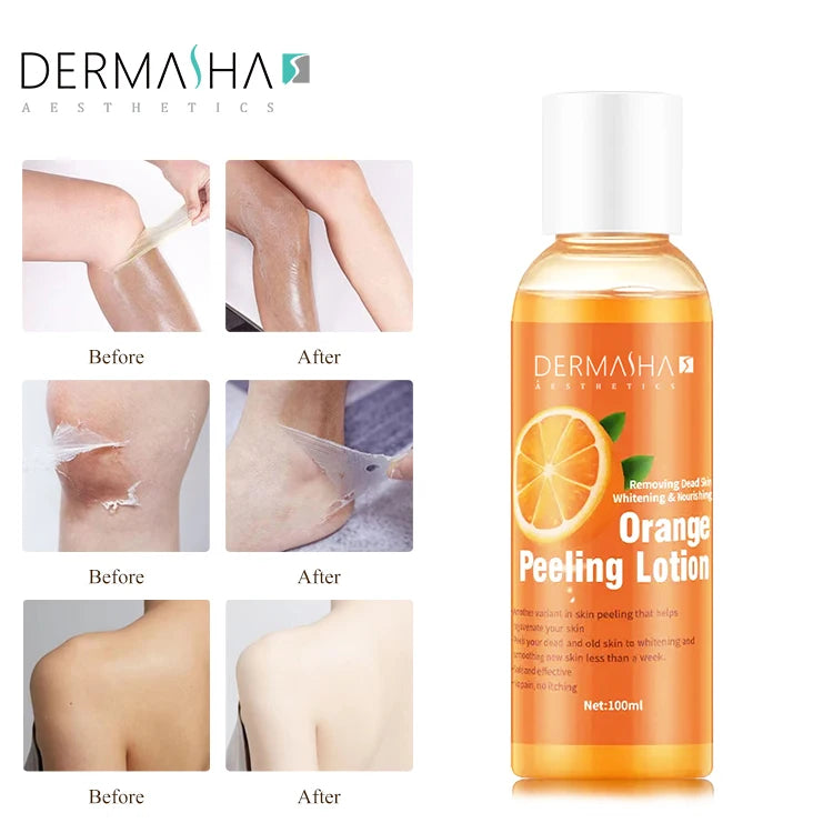 Private Label Skin Whitening Cream Organic Orange Peeling Lotion  Whitening Best Quality Peeling Oil for Removing Dead Skin