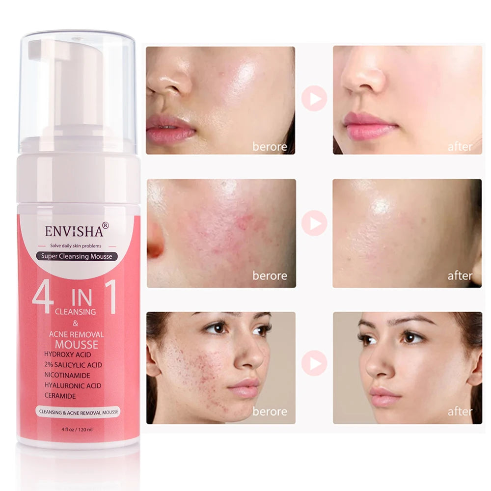 Private Label Korean Organic Cleansing Mousse BHA Salicylic Acid Acne Clear 4 in 1 Face Wash Facial Deep Foam Cleanser