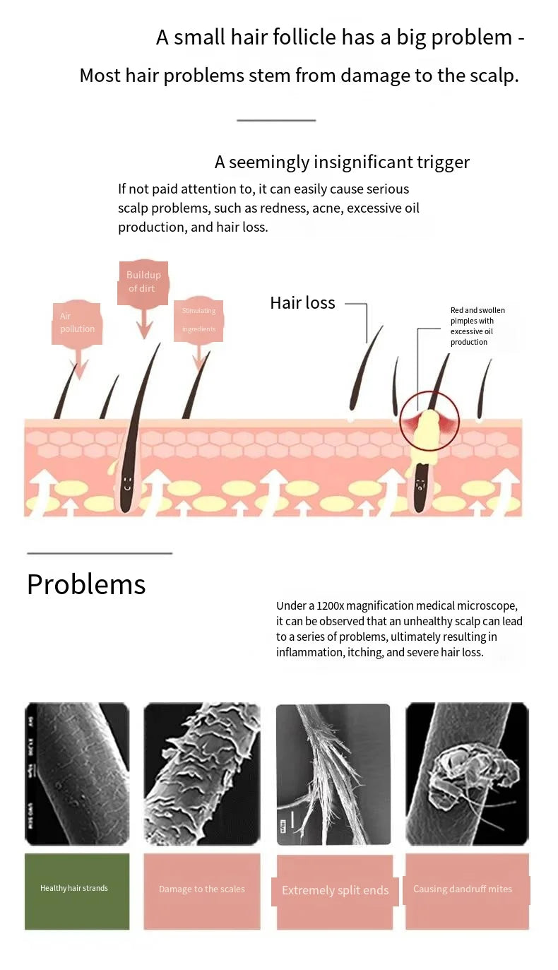 MOARCCI DNA Oil Control Anti-Hair Loss Hair Growth Set Hair Growth Serum Anti-Dandruff Shampoo Organic Rosemary Liquid
