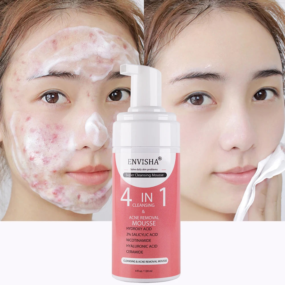 Private Label Korean Organic Cleansing Mousse BHA Salicylic Acid Acne Clear 4 in 1 Face Wash Facial Deep Foam Cleanser