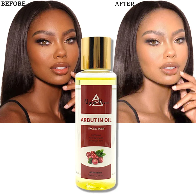 Alpine River Body Care Products 100% Organic Olive Oil Body Whitening Moisturizing Anti-Dark Spot Arbutin Massage Oil