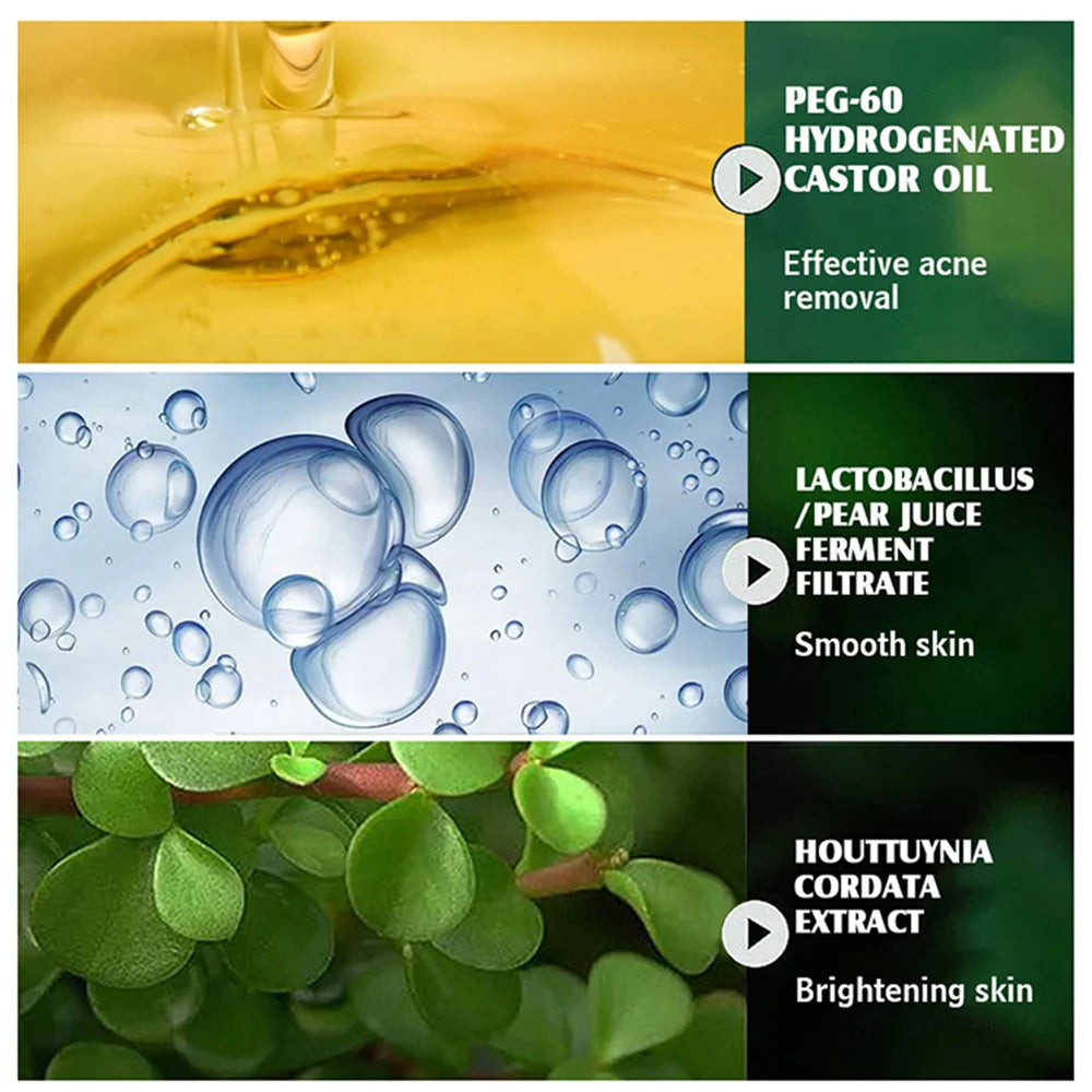 Boost Luster Organic Salicylic Acid Acne Removal Skin Care Face Anti Blemish Whitehead Remover Pimples Acne Cream for Face